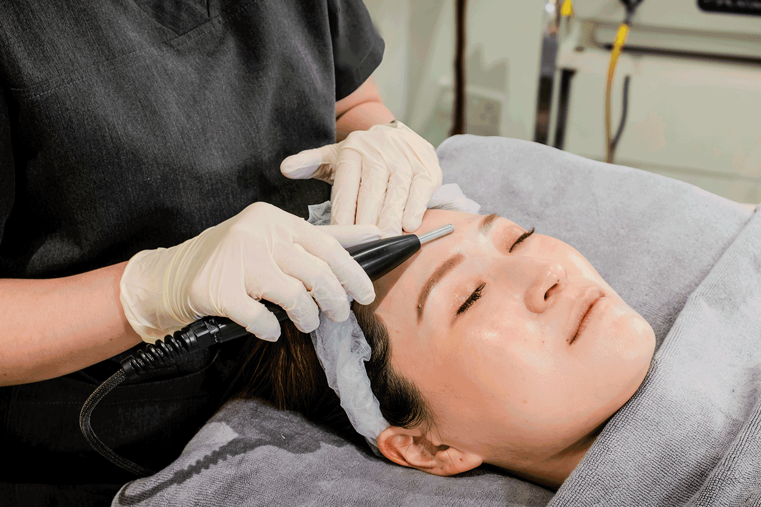Q Switch laser treatment Dubai